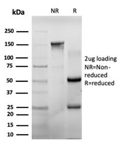 SDS-PAGE Analysis of Purified CHEK2 Mouse Monoclonal Antibody (PCRP-CHEK2-1A4). Confirmation of Purity and Integrity of Antibody.