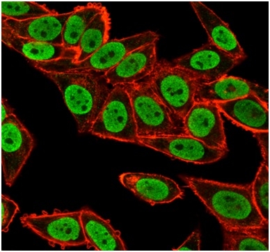 Immunofluorescence analysis of PFA-fixed HeLa cells. CHEK2 Mouse Monoclonal Antibody (PCRP-CHEK2-1A4) followed by goat anti-mouse IgG-CF488 (green). Microtubules stained with phalloidin.