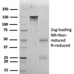 SDS-PAGE Analysis of Purified KLF12 Mouse Monoclonal Antibody (PCRP-KLF12-1E3). Confirmation of Purity and Integrity of Antibody.