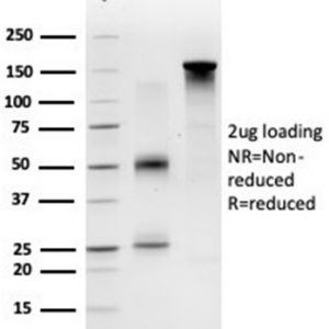 SDS-PAGE Analysis of Purified ECD Mouse Monoclonal Antibody (PCRP-ECD-1D10). Confirmation of Purity and Integrity of Antibody.