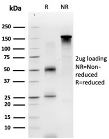 SDS-PAGE Analysis Purified ECD Mouse Monoclonal Antibody (PCRP-ECD-1D10). Confirmation of Purity and Integrity of Antibody.
