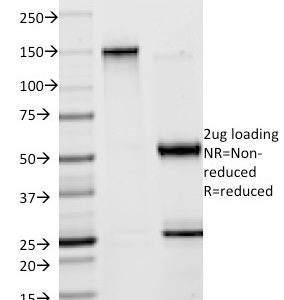 SDS-PAGE Analysis Purified Creatine Kinase-BB (CKBB) Mouse Monoclonal Antibody (2ba6). Confirmation of Purity and Integrity of Antibody.