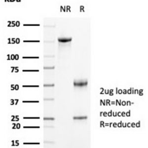 SDS-PAGE Analysis Purified CKBB Mouse Monoclonal Antibody (CKBB/6871). Confirmation of Purity and Integrity of Antibody