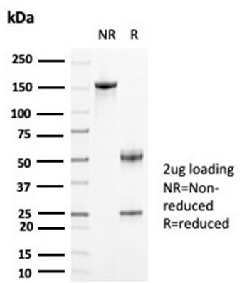 SDS-PAGE Analysis Purified CKBB Mouse Monoclonal Antibody (CKBB/6871). Confirmation of Purity and Integrity of Antibody