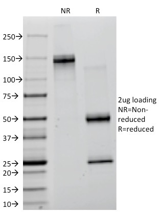 SDS-PAGE Analysis of Purified Creatine Kinase-B (CKB) Mouse Monoclonal Antibody (CKB/1268). Confirmation of Integrity and Purity of Antibody.