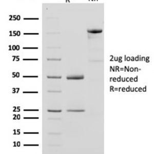 SDS-PAGE Analysis Purified CKBB Mouse Monoclonal Antibody (CPTC-CKB-2). Confirmation of Purity and Integrity of Antibody