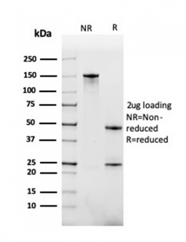 SDS-PAGE Analysis Purified CD268 / BAFFR Mouse Monoclonal Antibody (BAFFR/1558). Confirmation of Purity and Integrity of Antibody.