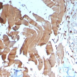 Formalin-fixed, paraffin-embedded human skeletal muscle stained with Creatine Kinase MM Mouse Monoclonal Antibody (CKMM/3341).