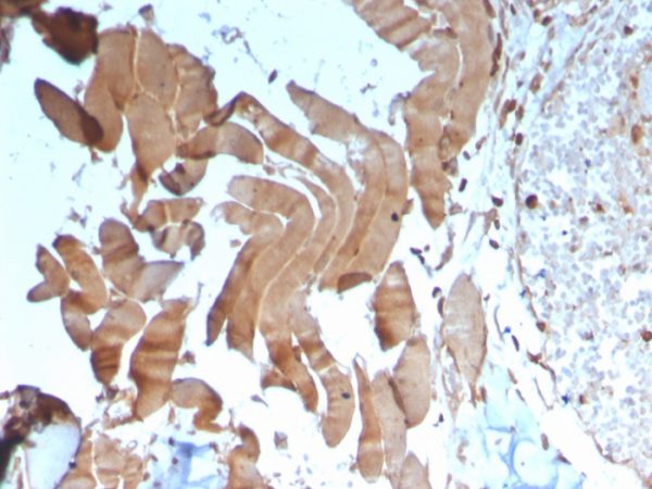 Formalin-fixed, paraffin-embedded human skeletal muscle stained with Creatine Kinase MM Mouse Monoclonal Antibody (CKMM/3341).