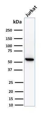 Western Blot Analysis of Jurkat cell lysate using Topo I, MT Mouse Monoclonal Antibody (TOP1MT/488).