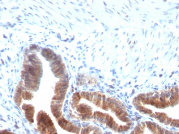 Formalin-fixed, paraffin-embedded human Gallbladder stained with Topo I, MT Mouse Monoclonal Antibody (TOP1MT/613).