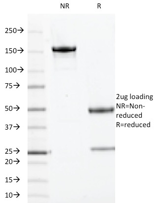 SDS-PAGE Analysis Purified Topo I, MT Mouse Monoclonal Antibody (TOP1MT/613). Confirmation of Purity and Integrity of Antibody.