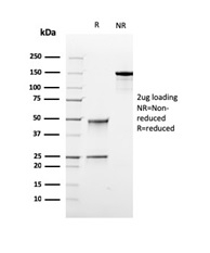SDS-PAGE Analysis Purified TOP1MT Recombinant Mouse Monoclonal Antibody (rTOP1MT/488). Confirmation of Purity and Integrity of Antibody.