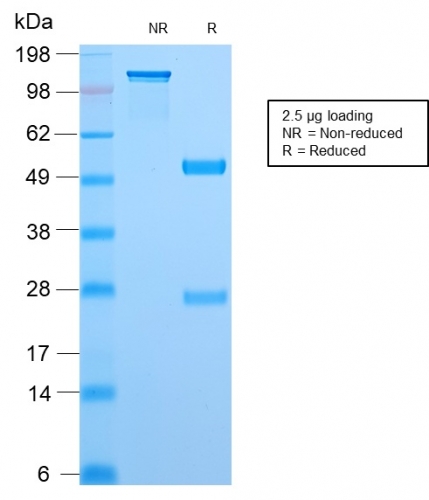 SDS-PAGE Analysis Purified Topo I Rabbit Recombinant Monoclonal Antibody (TOP1MT/2883R). Confirmation of Purity and Integrity of Antibody.