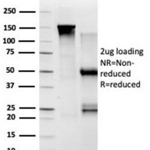 SDS-PAGE Analysis of Purified TADA1 Mouse Monoclonal Antibody (PCRP-TADA1-1C9). Confirmation of Purity and Integrity of Antibody.