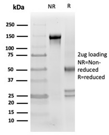 SDS-PAGE Analysis Purified Clusterin / APOJ Mouse Monoclonal Antibody (CLU/4721). Confirmation of Purity and Integrity of Antibody.