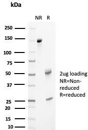 SDS-PAGE Analysis Purified Clusterin / APOJ Mouse Monoclonal Antibody (CLU/4733). Confirmation of Purity and Integrity of Antibody.