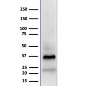 Western Blot Analysis of human testis lysate using Clusterin / APOJ Mouse Monoclonal Antibody (CLU/4723).