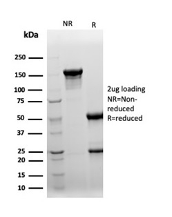 SDS-PAGE Analysis Purified Clusterin / APOJ Mouse Monoclonal Antibody (CLU/4727). Confirmation of Purity and Integrity of Antibody.