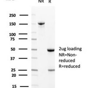 SDS-PAGE Analysis Purified Clusterin / APOJ Mouse Monoclonal Antibody (CLU/4729). Confirmation of Purity and Integrity of Antibody.