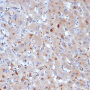 Formalin-fixed, paraffin-embedded human liver stained with Alpha-1-Antichymotrypsin Mouse Monoclonal Antibody (SERPINA3/4190).