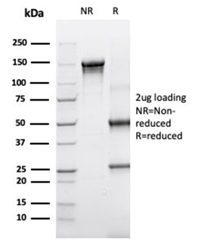 SDS-PAGE Analysis of Purified Alpha-1-Antichymotrypsin Monoclonal Antibody (SERPINA3/4190). Confirmation of Integrity and Purity of Antibody.