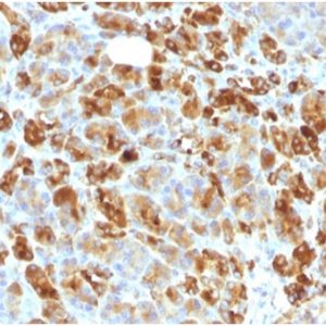 Formalin-fixed, paraffin-embedded human pancreas stained with Alpha-1-Antichymotrypsin Monoclonal Antibody (AACT/1451 + AACT/1452).