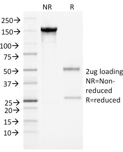 SDS-PAGE Analysis Purified Alpha-1-Antichymotrypsin Monoclonal Antibody (AACT/1452). Confirmation of Integrity and Purity of Antibody.