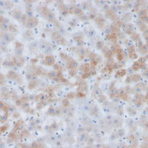 Formalin-fixed, paraffin-embedded human liver stained with Alpha-1-Antichymotrypsin Mouse Monoclonal Antibody (SERPINA3/4184).
