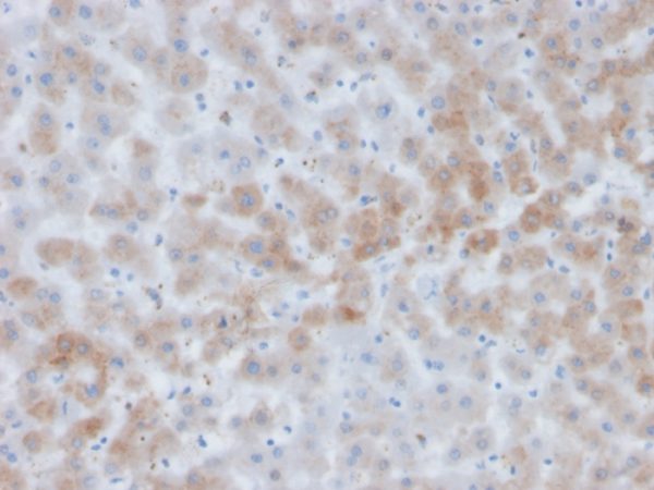 Formalin-fixed, paraffin-embedded human liver stained with Alpha-1-Antichymotrypsin Mouse Monoclonal Antibody (SERPINA3/4184).
