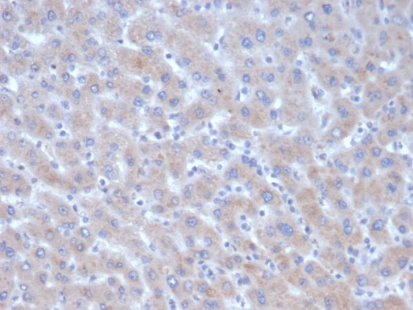 Formalin-fixed, paraffin-embedded human liver stained with Alpha-1-Antichymotrypsin Mouse Monoclonal Antibody (SERPINA3/4185).