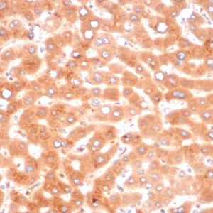Formalin-fixed, paraffin-embedded human liver stained with Alpha-1-Antichymotrypsin Mouse Monoclonal Antibody (SERPINA3/4187).