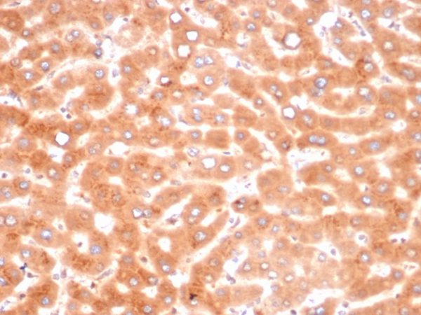 Formalin-fixed, paraffin-embedded human liver stained with Alpha-1-Antichymotrypsin Mouse Monoclonal Antibody (SERPINA3/4187).