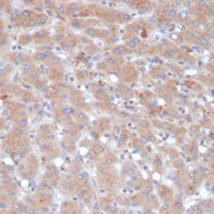 Formalin-fixed, paraffin-embedded human liver stained with Alpha-1-Antichymotrypsin Mouse Monoclonal Antibody (SERPINA3/4189).