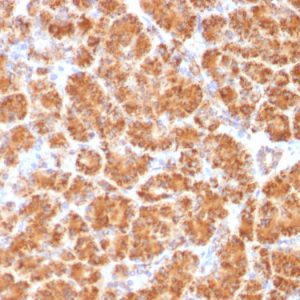 Formalin-fixed, paraffin-embedded human Pancreas stained with Clathrin, LC Monoclonal Antibody (CLC/1421).