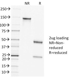 SDS-PAGE Analysis of Purified Clathrin HC Mouse Monoclonal Antibody (CLTC/1431). Confirmation of Purity and Integrity of Antibody.
