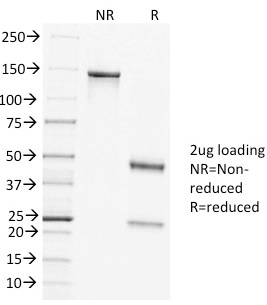 SDS-PAGE Analysis of Purified Clathrin HC Mouse Monoclonal Antibody (CLTC/1431). Confirmation of Purity and Integrity of Antibody.