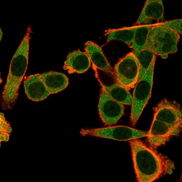 Immunofluorescent Analysis of PFA-fixed HeLa cells. SPIC Mouse Monoclonal Antibody (PCRP-SPIC-2C5) followed by IgG-CF488 (green), counterstained with phalloidin.