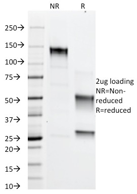 SDS-PAGE Analysis Purified Adipophilin Mouse Monoclonal Antibody (ADFP/1366). Confirmation of Integrity and Purity of Antibody.
