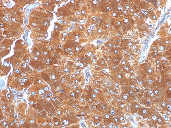 Formalin-fixed, paraffin-embedded human Adrenal stained with Adipophilin Mouse Monoclonal Antibody (ADFP/1494).
