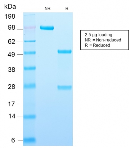 SDS-PAGE Analysis of Purified Adipophilin Recombinant Rabbit Monoclonal Antibody (ADFP/2755R). Confirmation of Integrity and Purity of Antibody.