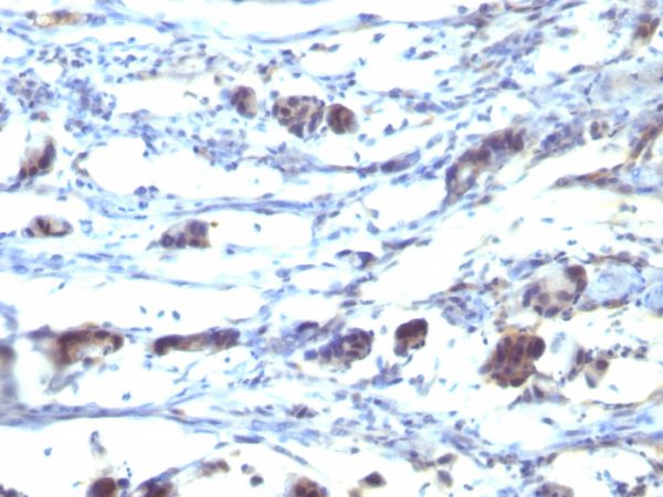 Formalin-fixed, paraffin-embedded human Stomach tissue stained with CD195 Mouse Monoclonal Antibody (12D1).