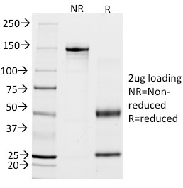 SDS-PAGE Analysis Purified Calponin-1 Mouse Monoclonal Antibody (CALP). Confirmation of Purity and Integrity of Antibody