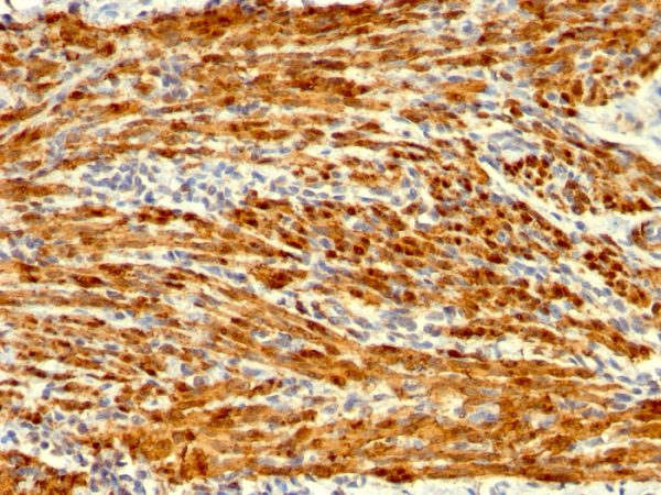Formalin-fixed, paraffin-embedded human Uterus stained with Calponin-1 Monoclonal Antibody (SPM169).