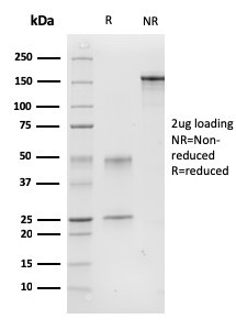 SDS-PAGE Analysis Purified Calponin-1 Mouse Monoclonal Antibody (CNN1/832). Confirmation of Purity and Integrity of Antibody
