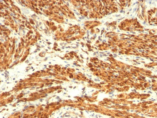 Formalin-fixed, paraffin-embedded human Uterus stained with Calponin-1 Mouse Monoclonal Antibody (CNN1/832 + CALP).