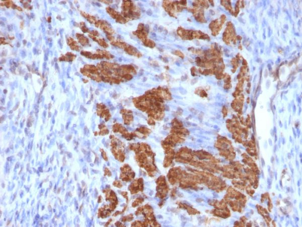 Formalin-fixed, paraffin-embedded Rat Uterus stained with Calponin-1 Mouse Monoclonal Antibody (CNN1/832 + CALP).
