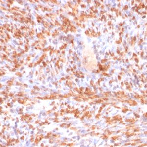 Formalin-fixed, paraffin-embedded human Uterus stained with Calponin-1 Recombinant Mouse Monoclonal Antibody (rCNN1/832).