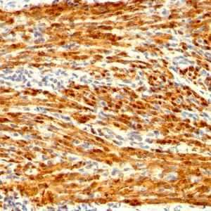 Formalin-fixed, paraffin-embedded human Uterus stained with Calponin Rabbit Recombinant Monoclonal Antibody (CNN1/1408R).