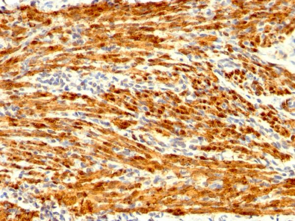 Formalin-fixed, paraffin-embedded human Uterus stained with Calponin Rabbit Recombinant Monoclonal Antibody (CNN1/1408R).